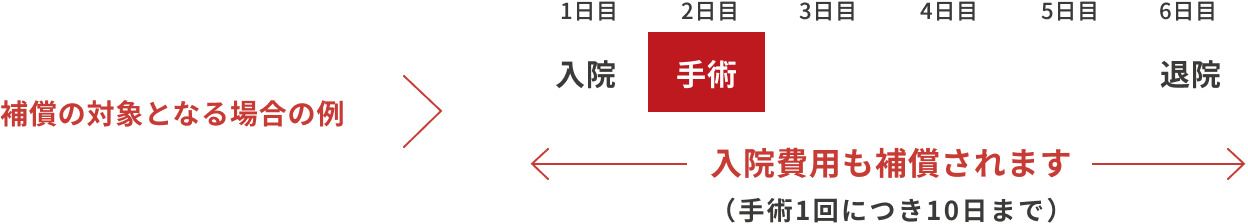 補償の対象となる場合の例