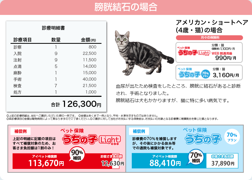 膀胱結石の診療費例