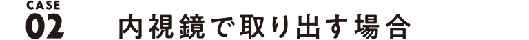 内視鏡で取り出す場合